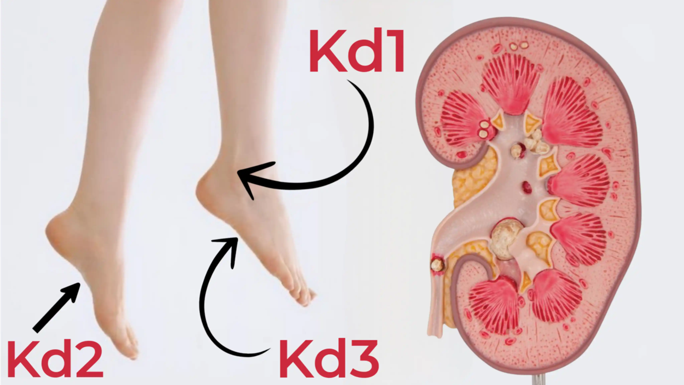 Acupressure points for kidney stones